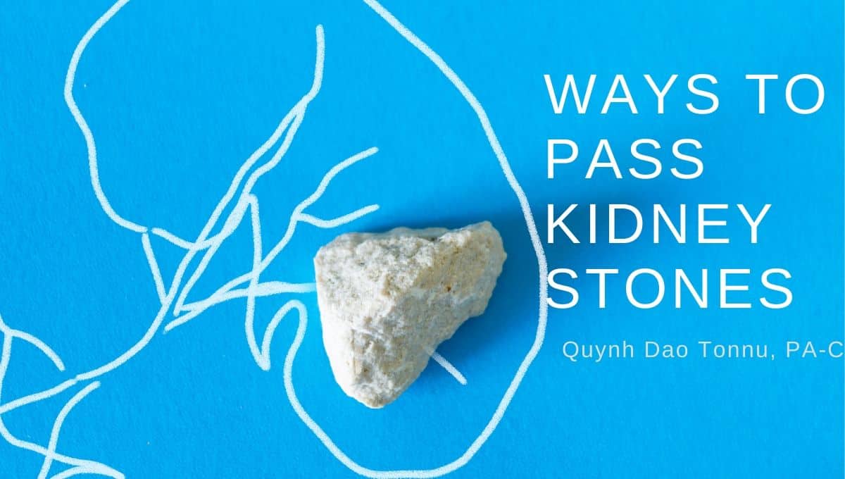Ways to Pass Kidney Stones