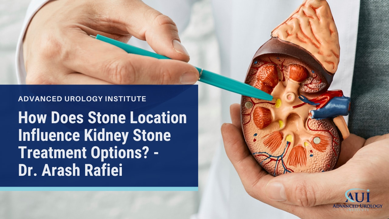 How Does Stone Location Influence Kidney Stone Treatment Options? – Dr. Arash Rafiei