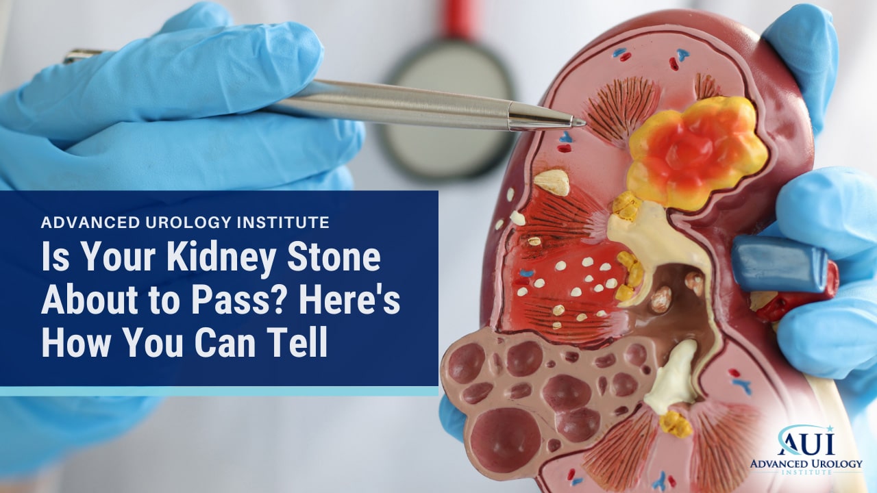 Is Your Kidney Stone About to Pass? Here’s How You Can Tell