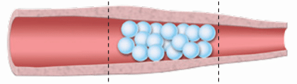 PAE Microsphere Diagram