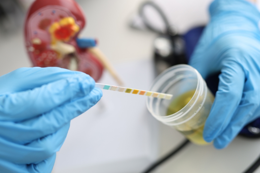 Microscopic Hematuria